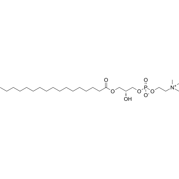 1-Heptadecanoyl-2-hydroxy-sn-glycero-3-phosphocholine Chemical Structure