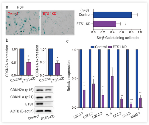 Fig. 4 Functional study of down-regulated ETS1 at cellular level