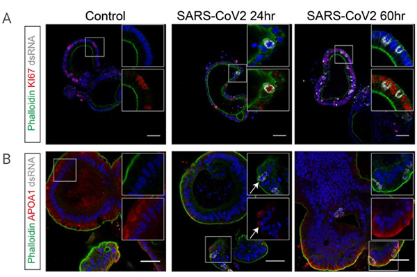 Figure 4. Immunofluorescent staining of SARS-CoV-2 infected hSIO